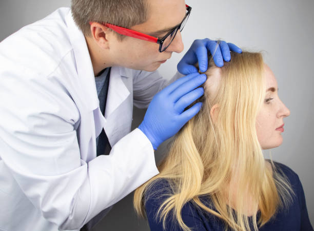 What Alopecia Areata Treatment Shows Quick Results