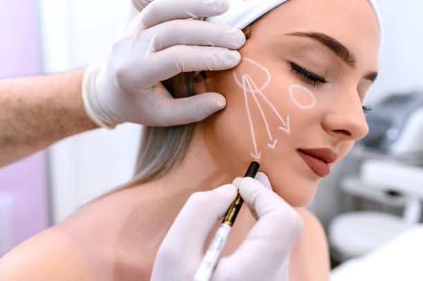 What makes Facelift Surgery popular?