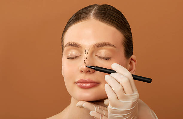 What to Expect During Rhinoplasty First Consultation