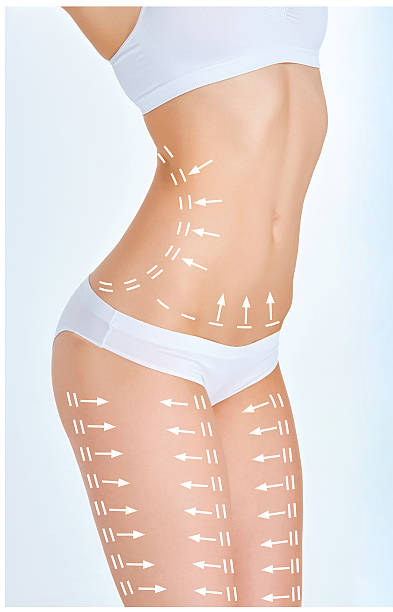 Why Choose Bodytite Liposuction for Fat Reduction