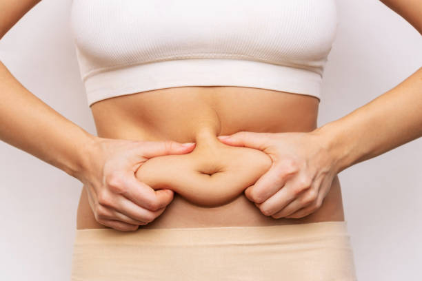 Why Choose Tummy Tuck for a Flatter, Firmer Stomach