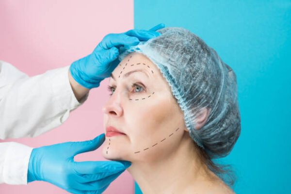 Can Facelift Tighten Loose Skin Without Scarring