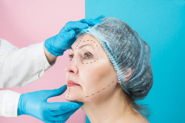 Can Facelift Tighten Loose Skin Without Scarring