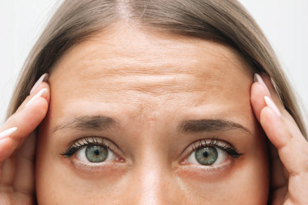 Can Forehead Lift Smooth Fine Lines Effectively?