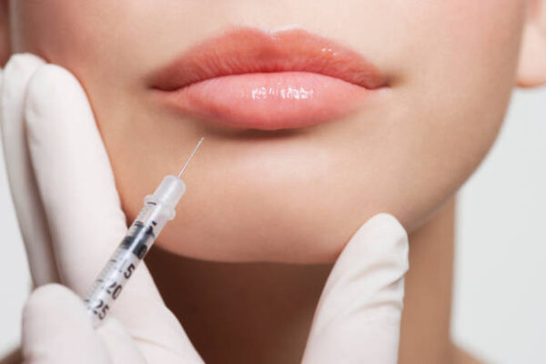 Can Russian Lip Fillers Fix Uneven Lip Volume? Can Russian Lip Fillers Fix Uneven Lip Volume