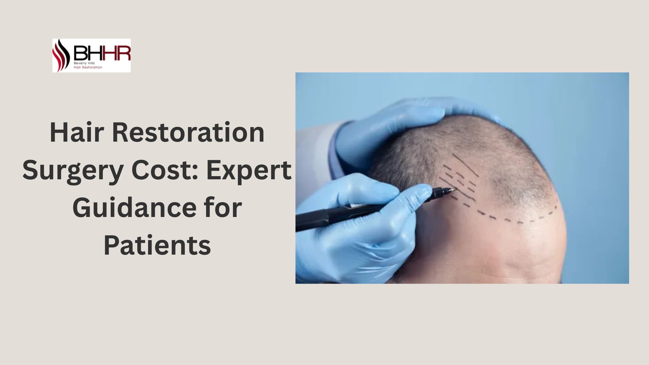 cost of hair restoration surgery
