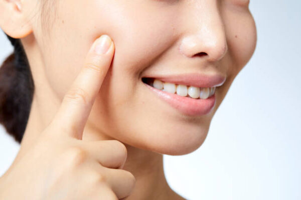 How Long Does Cheek Augmentation Last for? How Long Does Cheek Augmentation Last for