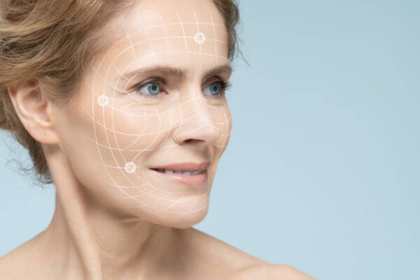 How Long Does a Vector Facelift Usually Last? How Long Does a Vector Facelift Usually Last?