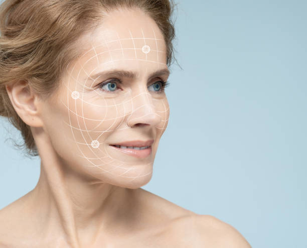 How Long Does a Vector Facelift Usually Last?