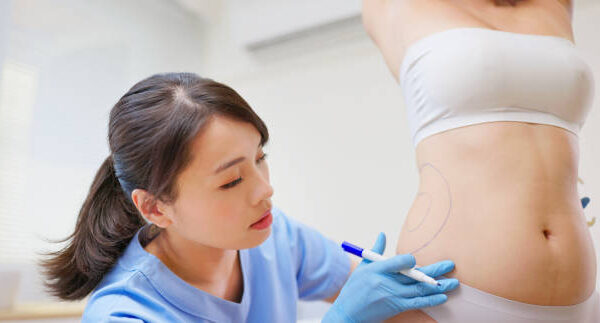 How Much Fat Can Liposuction Surgery Remove? How Much Fat Can Liposuction Surgery Remove?