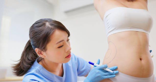 How Much Fat Can Liposuction Surgery Remove?