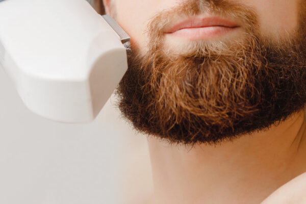 Is Beard Laser Hair Removal Effective for Patchy Growth? Is Beard Laser Hair Removal Effective for Patchy Growth?