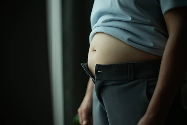 Is Liposuction Surgery Permanent for Fat Loss?