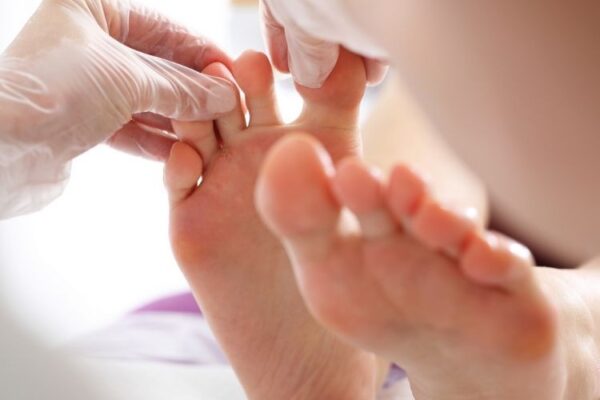 Foot Dermatology and Skin Treatments in Edinburgh Foot Dermatology and Skin Treatments in Edinburgh