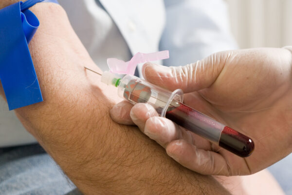 What Equipment Is Used for a Blood Test at Home