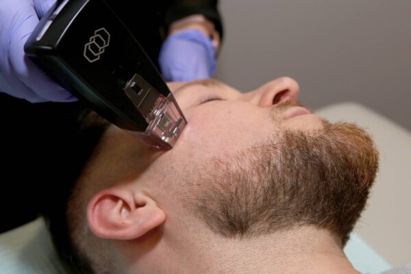 What Makes Morpheus 8 Treatment Unique? What Makes Morpheus 8 Treatment Unique?