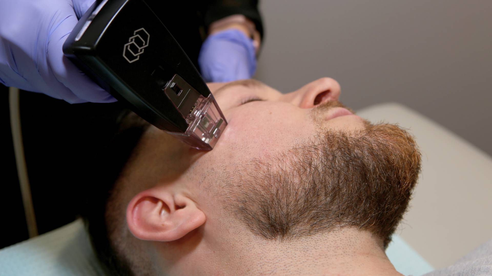 What Makes Morpheus 8 Treatment Unique?