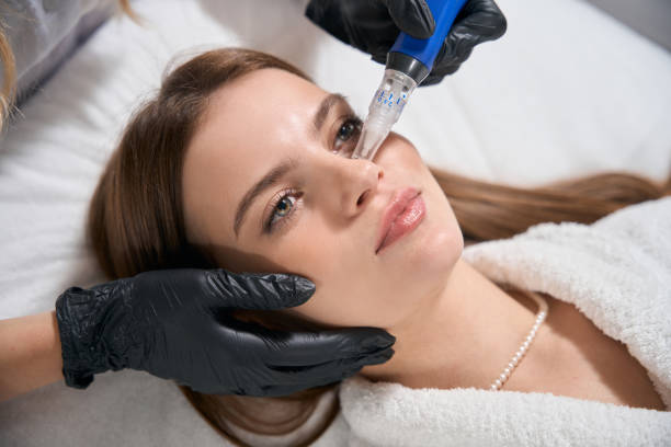 Why Choose Dermapen Microneedling for Anti-Aging Care