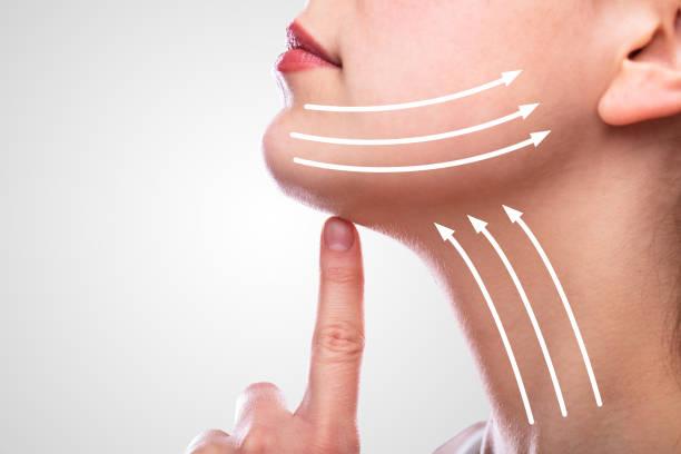 Why Choose Neck Lift for Long-Lasting Results