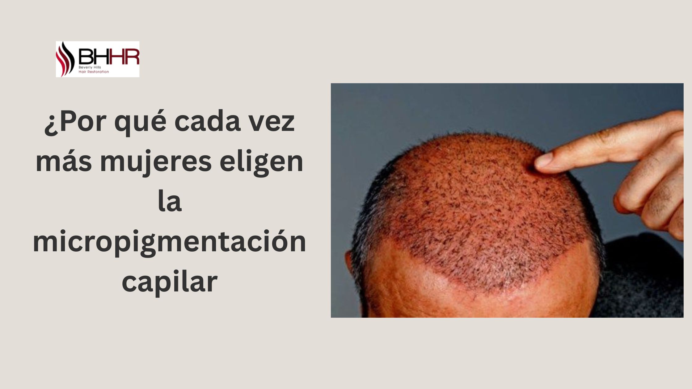 micropigmentación capilar