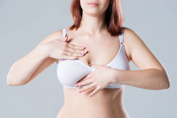 How Breast Reduction Helps You Embrace Fitness