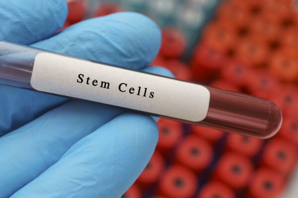 How Do Mesenchymal Stem Cell Therapy Procedures Work?