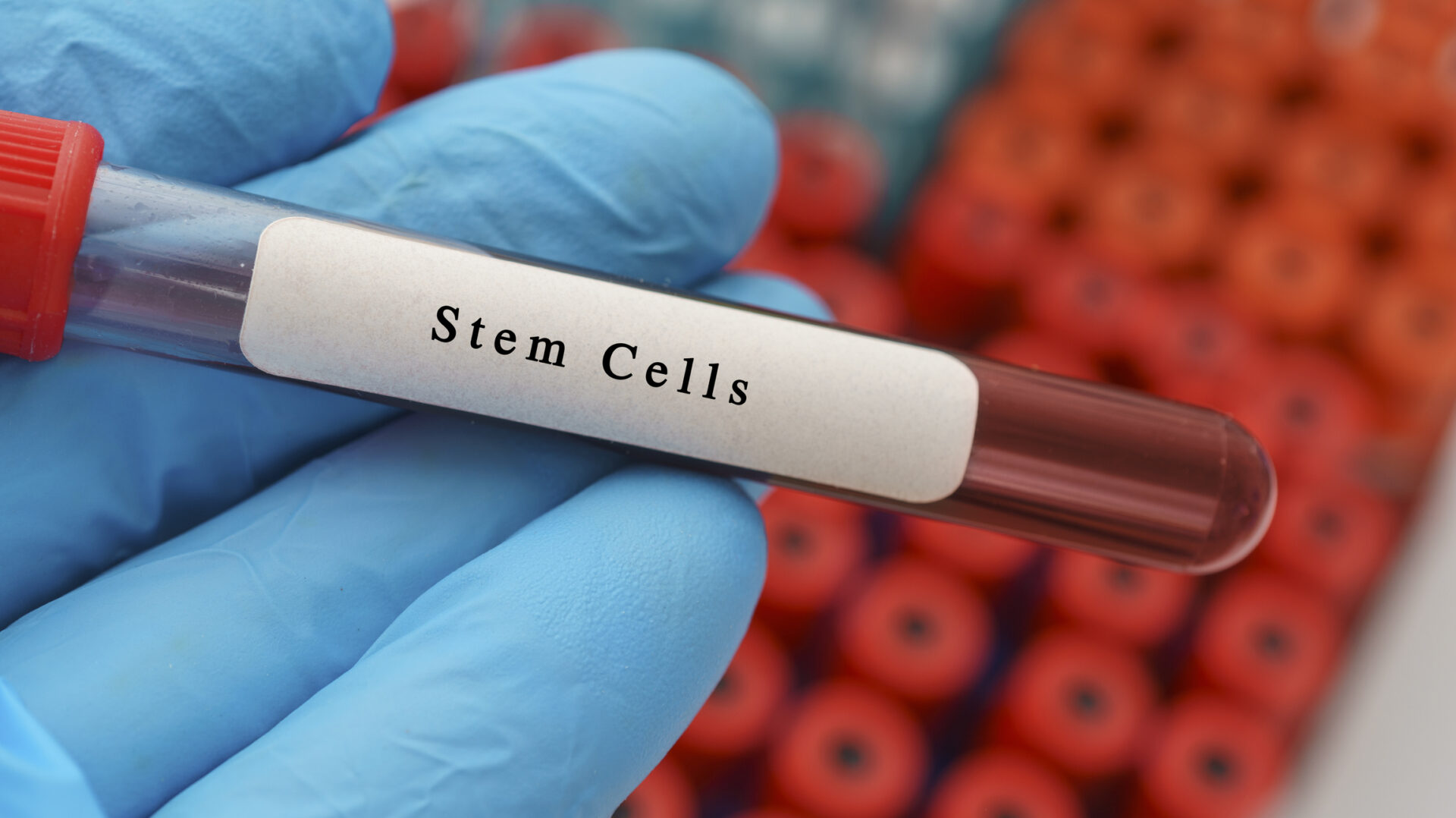 How Do Mesenchymal Stem Cell Therapy Procedures Work?