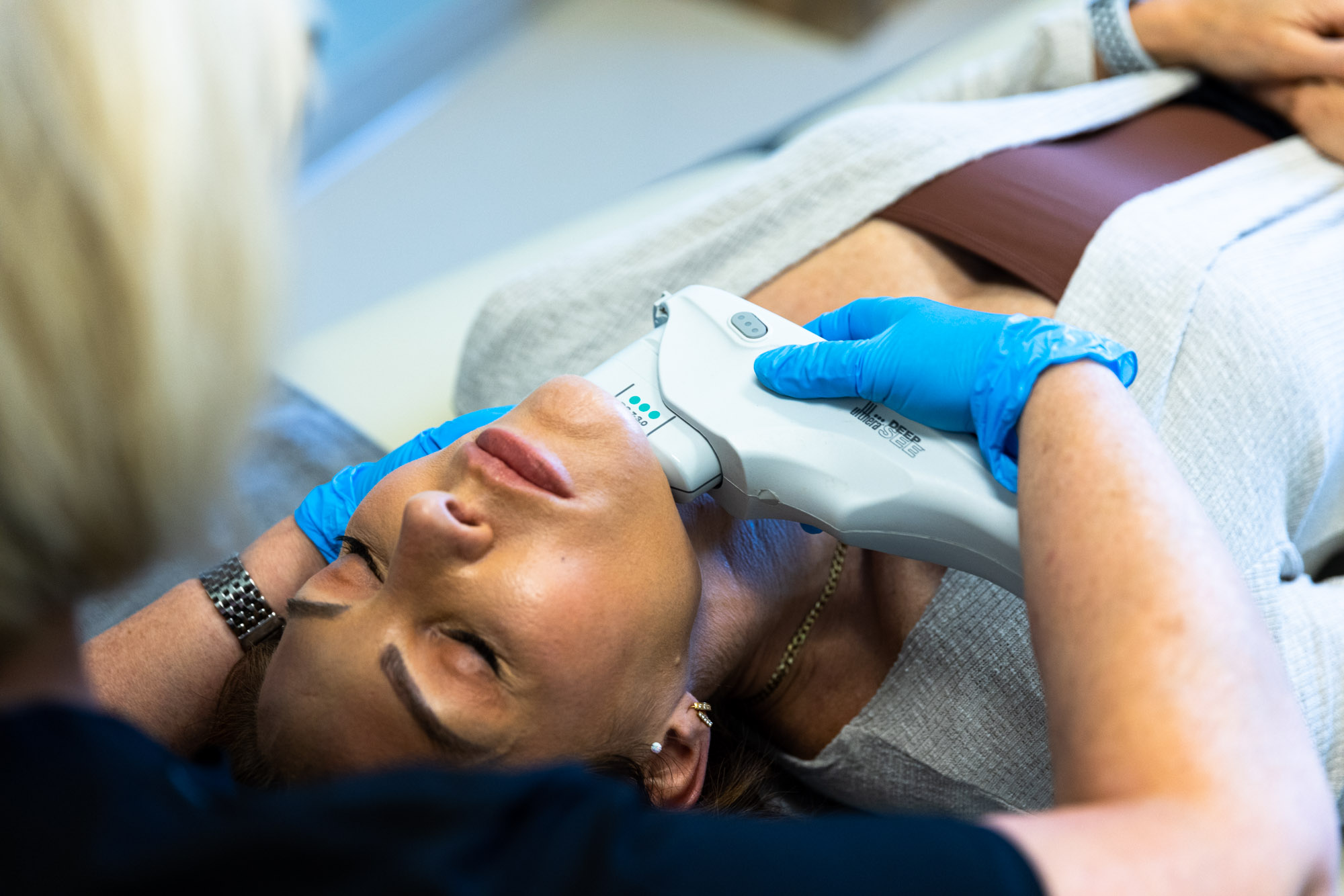 How Long Do Ultherapy Results Last After One Session?