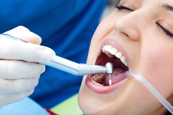 How Root Canal Prevents Future Dental Complications
