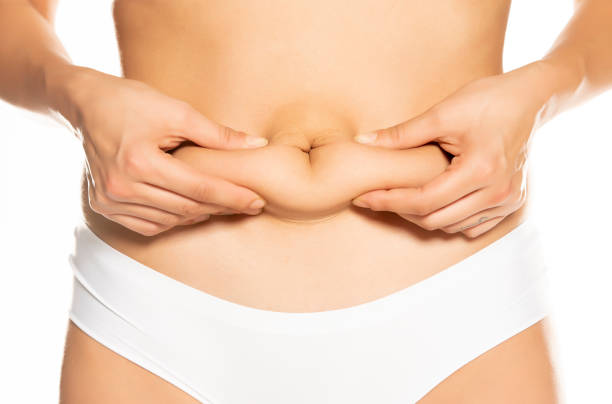 Is Mini Abdominoplasty Effective for Mild Skin Laxity