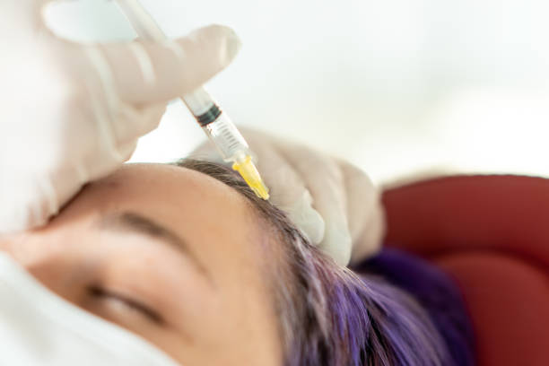 Is PRP Hair Growth Therapy Painful or Easy?