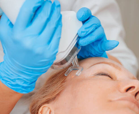Why People Trust Fractional CO2 Laser Treatment for Glow