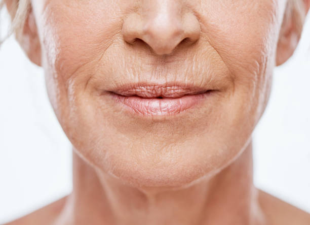 Do Anti Wrinkles Injections Help Refresh Your Look?