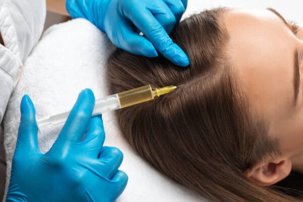 Does Hair Fillers Treatment Work on Chronic Hair Fall