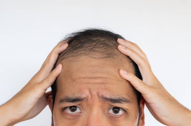 How GFC Treatment Nourishes Hair Follicles