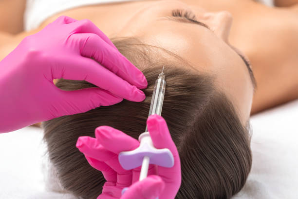 How PRP Hair Restoration Improves Density Fast?