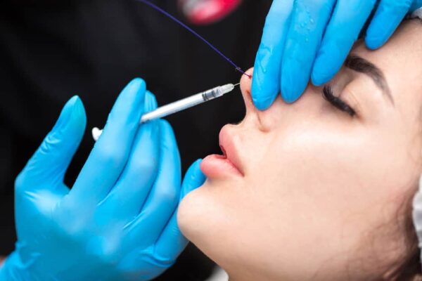 Is Hiko Nose Thread Lift Better Than Nose Fillers