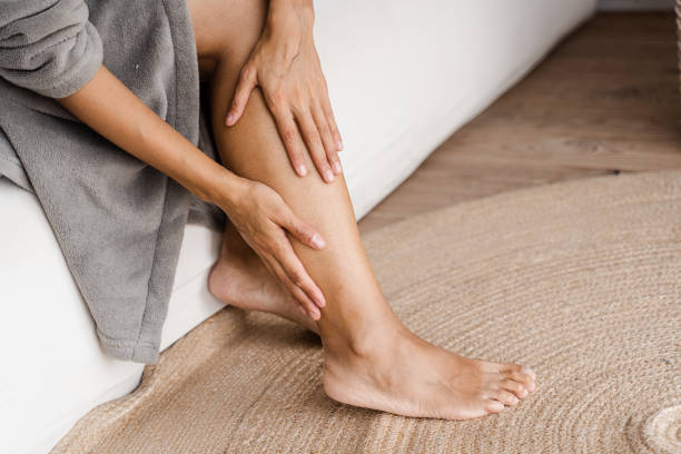 Is Sclerotherapy the Best Fix for Spider Veins?