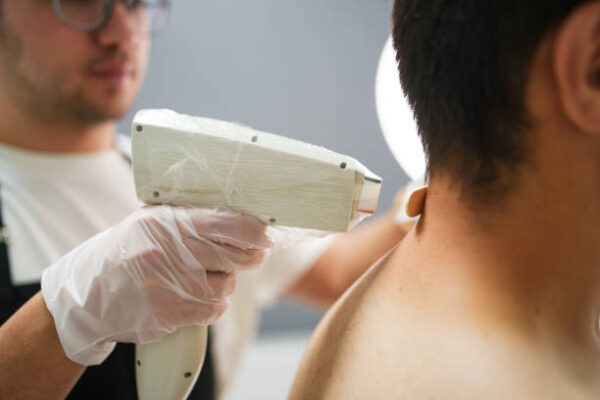 What Age Is Right for Men’s Laser Hair Removal