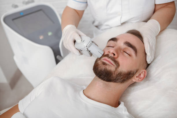 Can Beard Laser Hair Removal Fix Patchy Beard Growth
