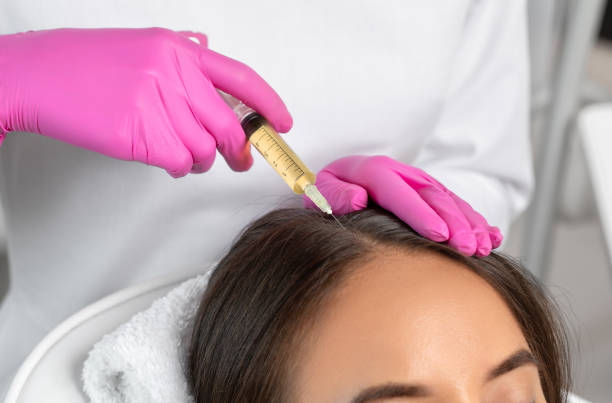 Can the Best PRP Hair Treatment Improve Hair Density