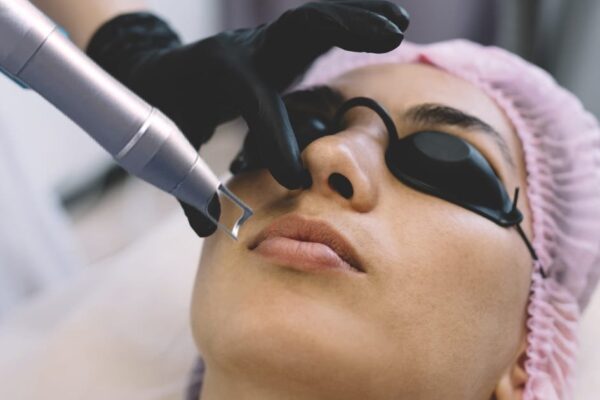 How Pico Laser Treatment Boosts Skin Clarity