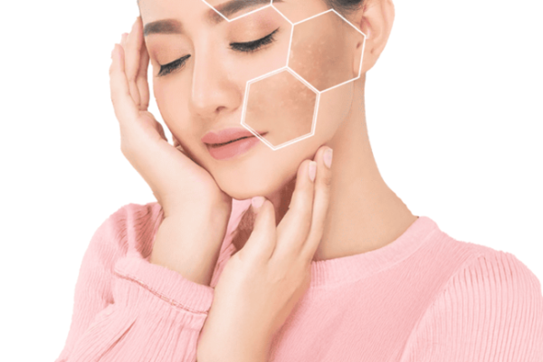 How Pigmentation Treatment Restores Even Complexion