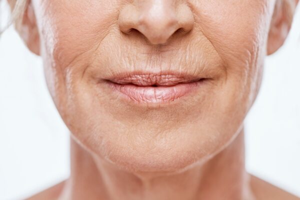 How Smoker’s Lips Treatment Reduces Lip Wrinkles