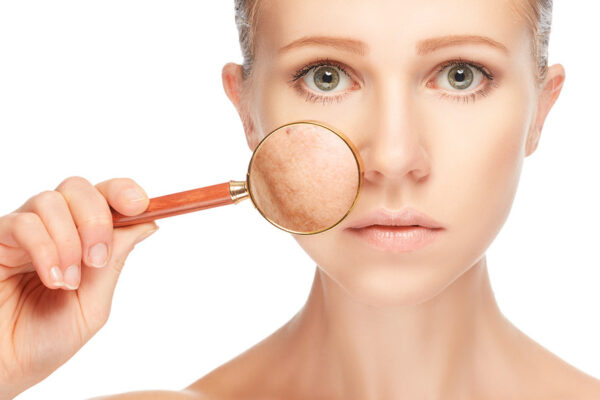 Is Pigmentation Treatment Effective for Sun Damage