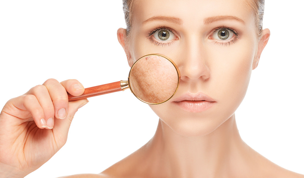 Is Pigmentation Treatment Effective for Sun Damage