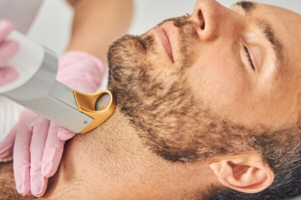 What Are Benefits of Beard Laser Hair Removal