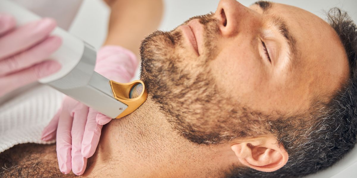 What Are Benefits of Beard Laser Hair Removal