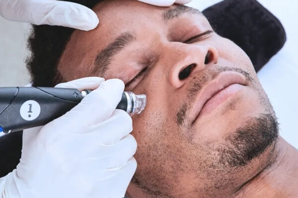 What Results to Expect from Hydrafacial for Men